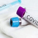 2020_04_13_covid-19_provetta