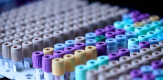 Ultime notizie dal Coronavirus: studio rivela il fattore di rischio principale che porta al ricovero in ospedale Ricerca scientifica in laboratorio. Immagine di repertorio.