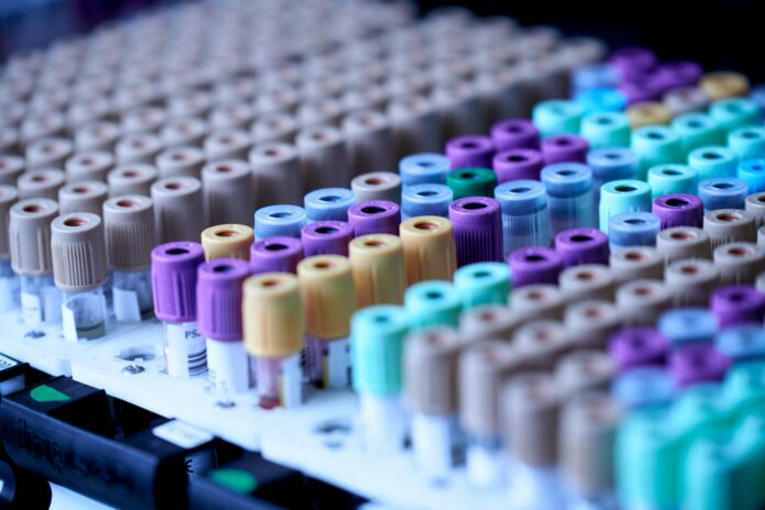 Laboratorio_Provette_testalize-me-0jE8ynV4mis-unsplash Ricerca scientifica in laboratorio. Immagine di repertorio.